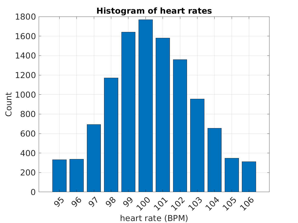 S026_ecg_hr_hist