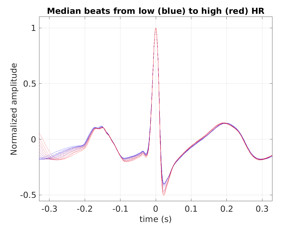 S026_ecg_med_beats_hr_binned