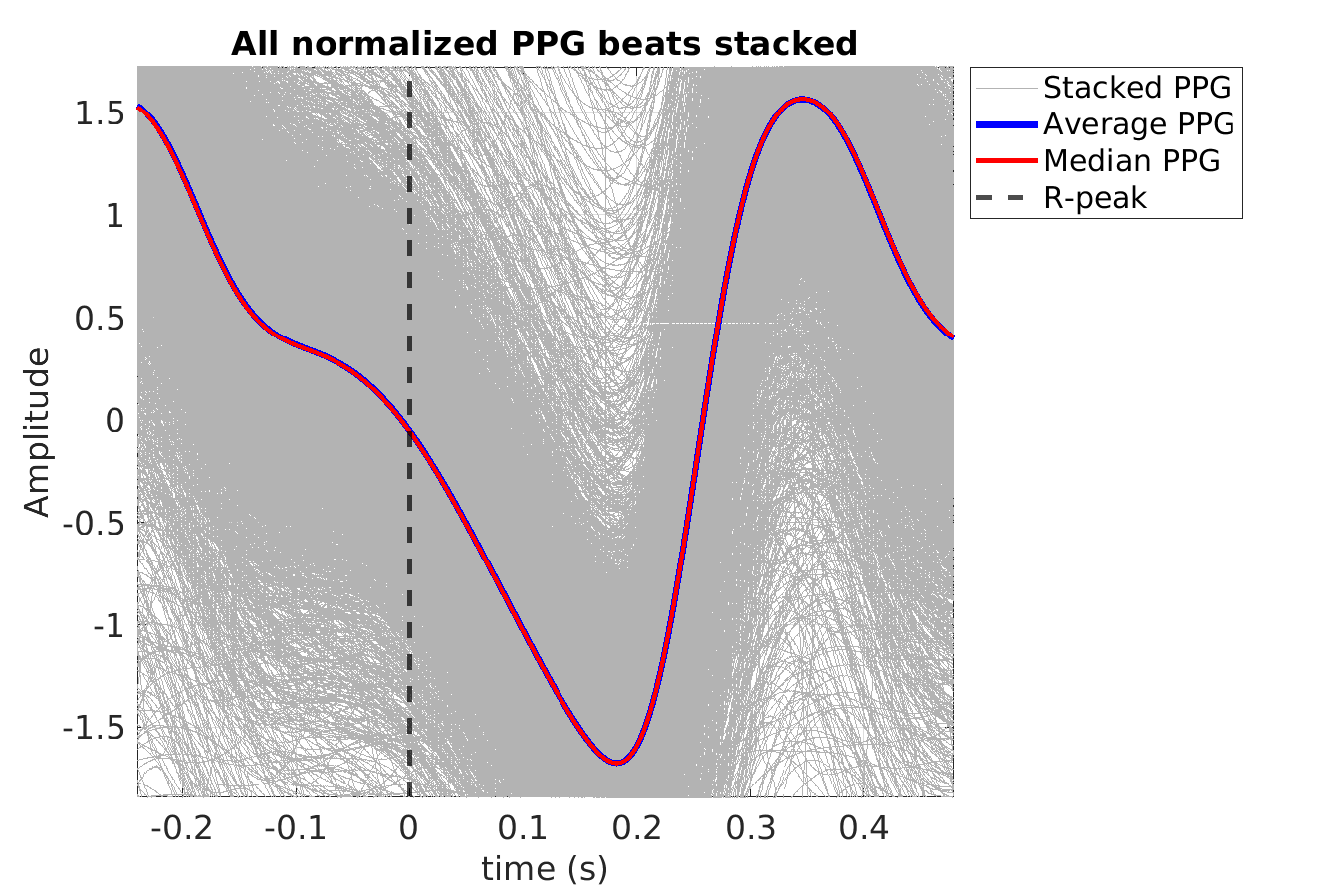 S026_ppg_ppg_stacked_norm