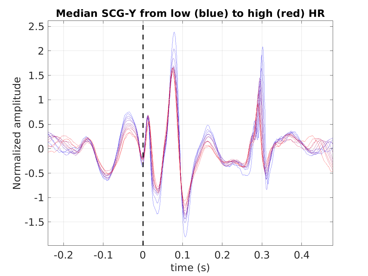 S026_scg_med_scgy_hr_binned_norm