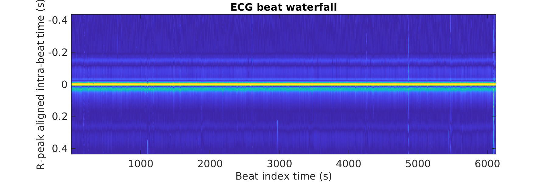 S027_ecg_beats_waterfall