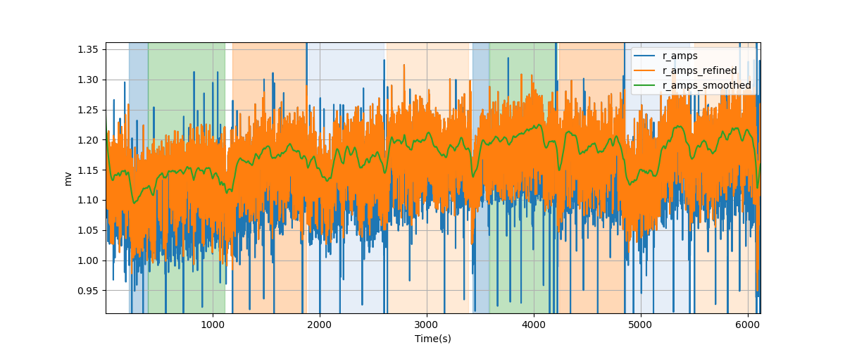 R-wave amplitudes - Overlay