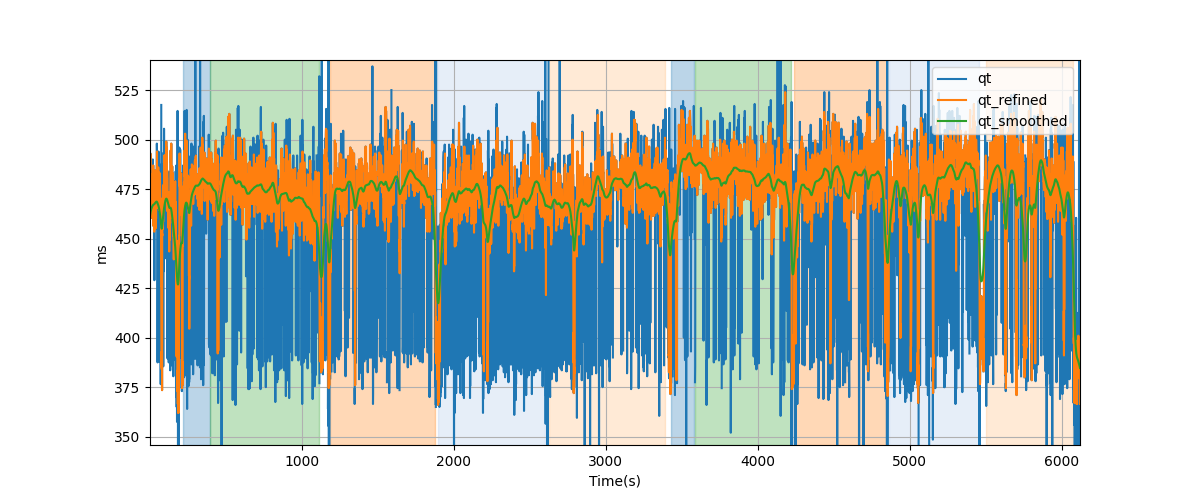 QT intervals - Overlay