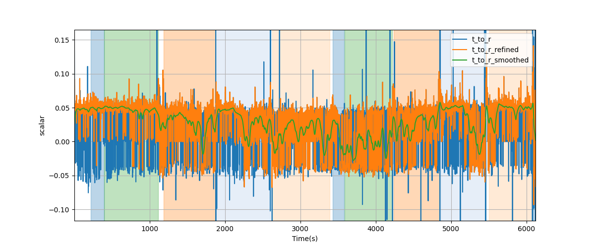 T/R wave ratio - Overlay