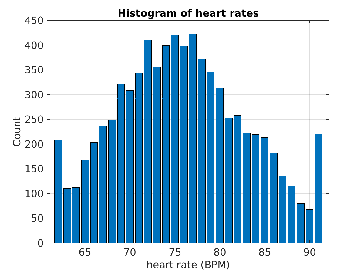 S027_ecg_hr_hist