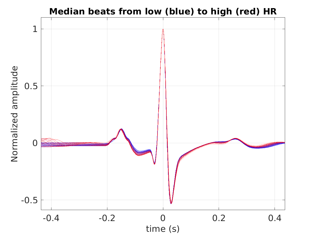 S027_ecg_med_beats_hr_binned