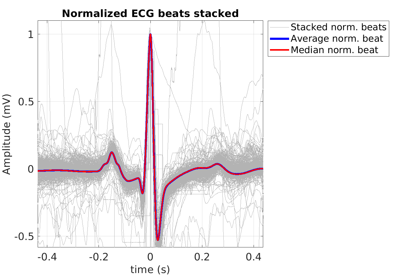 S027_ecg_norm_beats_stacked