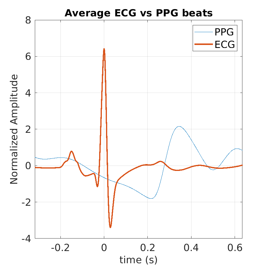 S027_ppg_avg_ecg_ppg