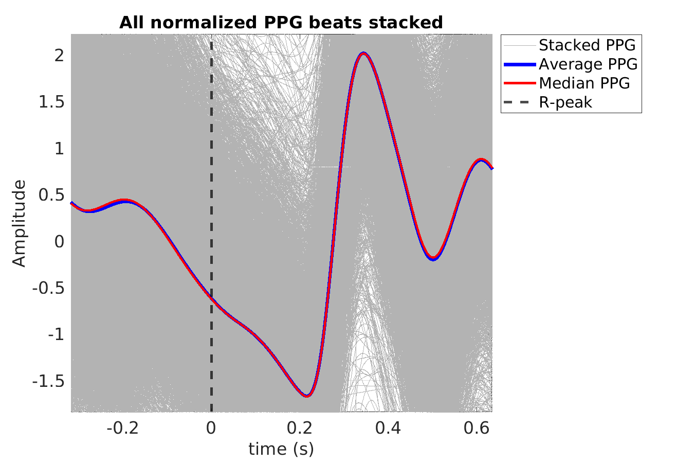 S027_ppg_ppg_stacked_norm