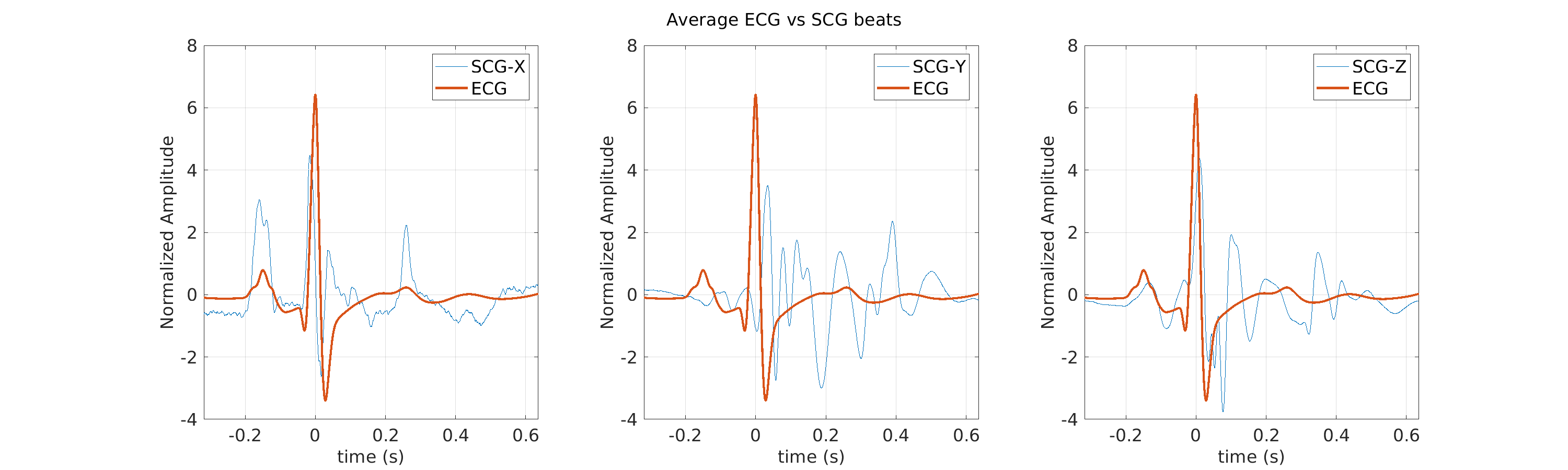 S027_scg_avg_ecg_scg