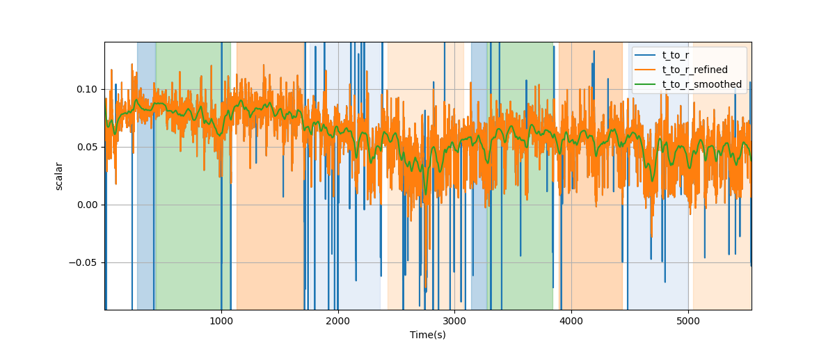 T/R wave ratio - Overlay