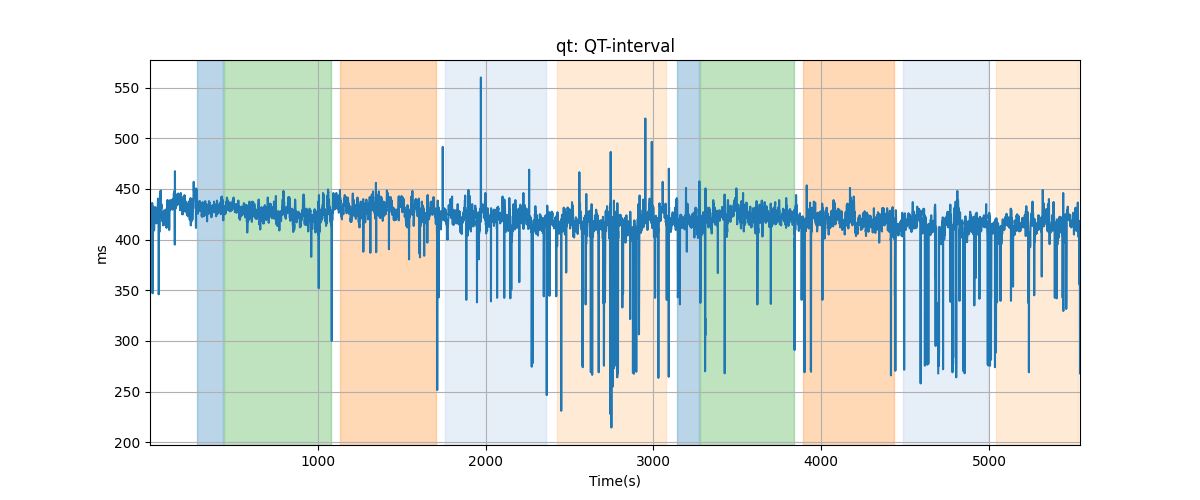 qt: QT-interval