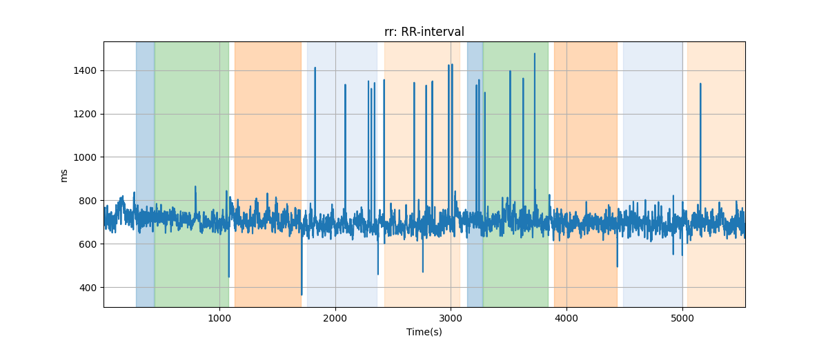 rr: RR-interval