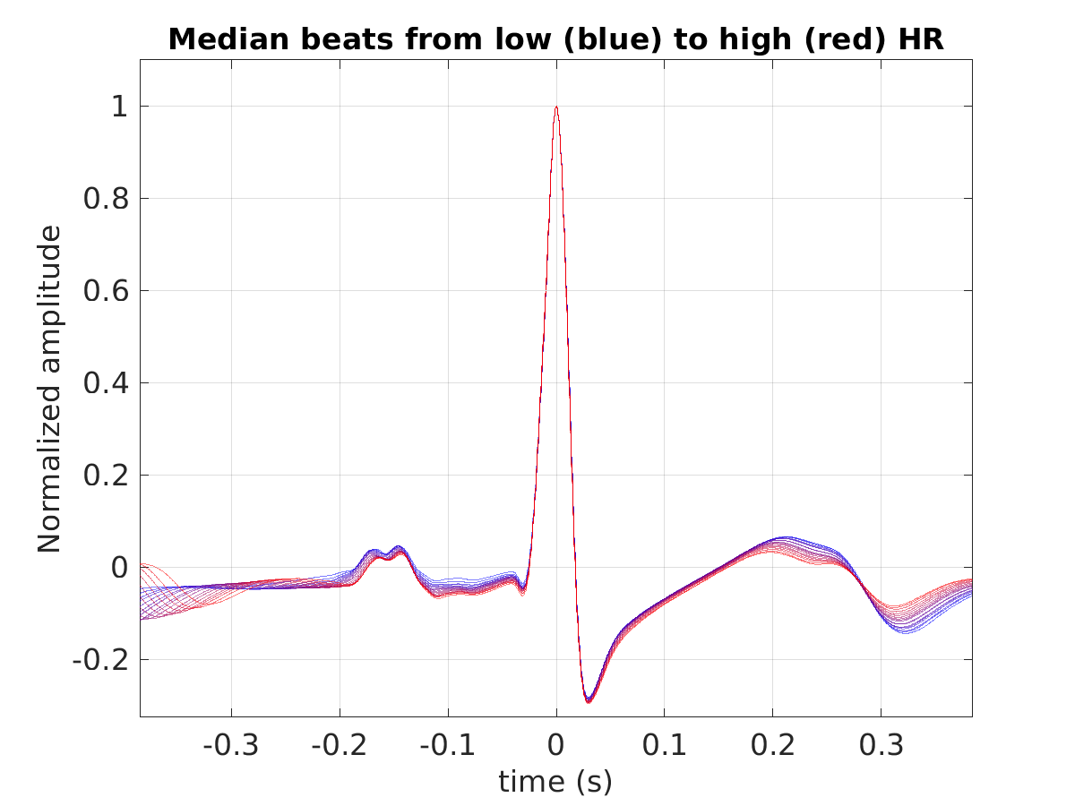 S028_ecg_med_beats_hr_binned