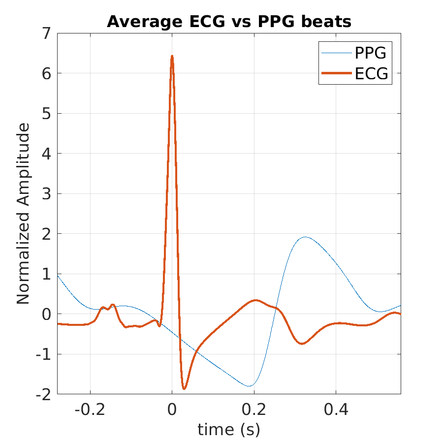 S028_ppg_avg_ecg_ppg