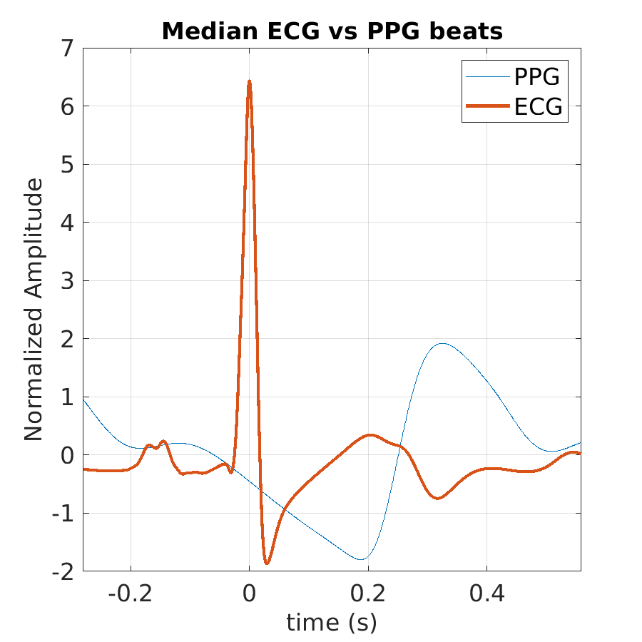 S028_ppg_med_ecg_ppg