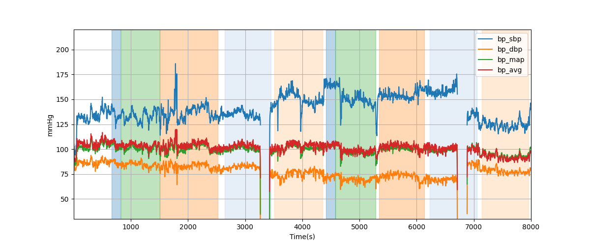 Subject S029 blood pressure data processing summary - Overlay