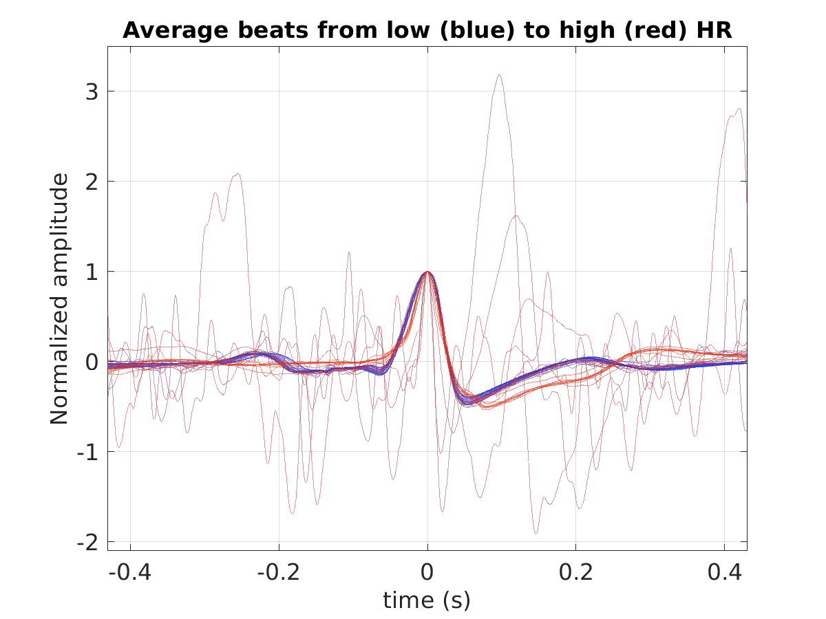 S029_ecg_avg_beats_hr_binned