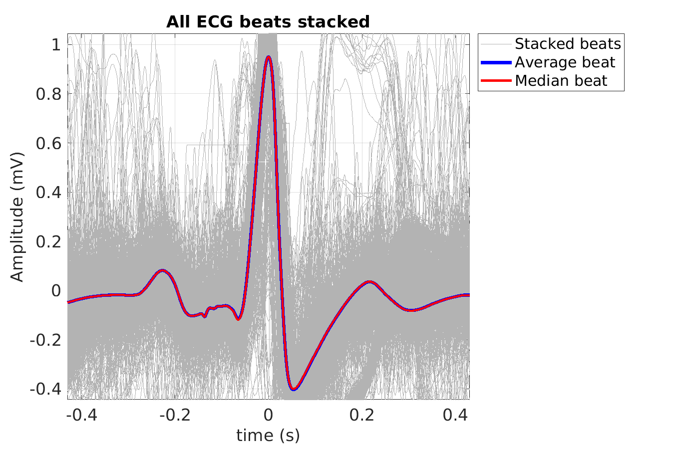 S029_ecg_beats_stacked