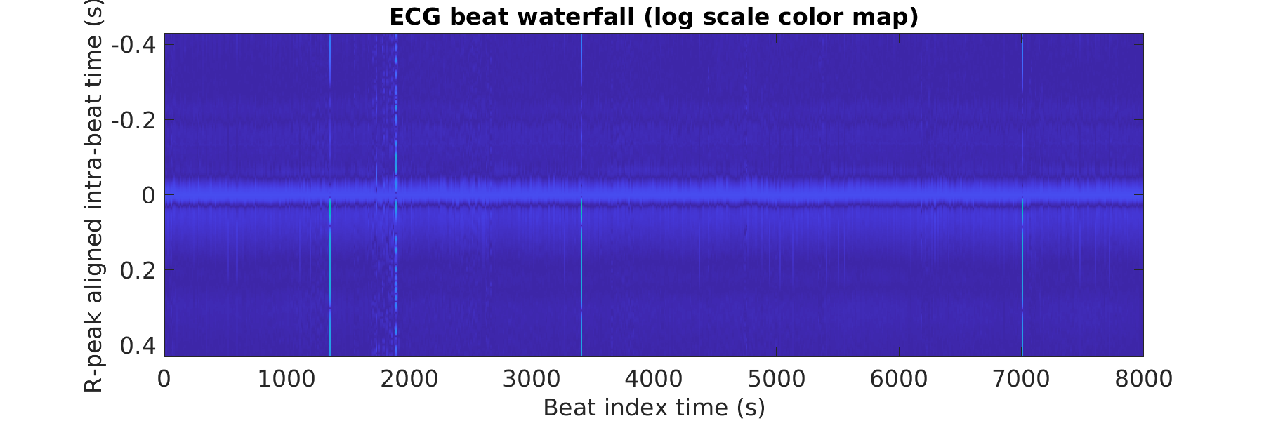 S029_ecg_beats_waterfall_logscale