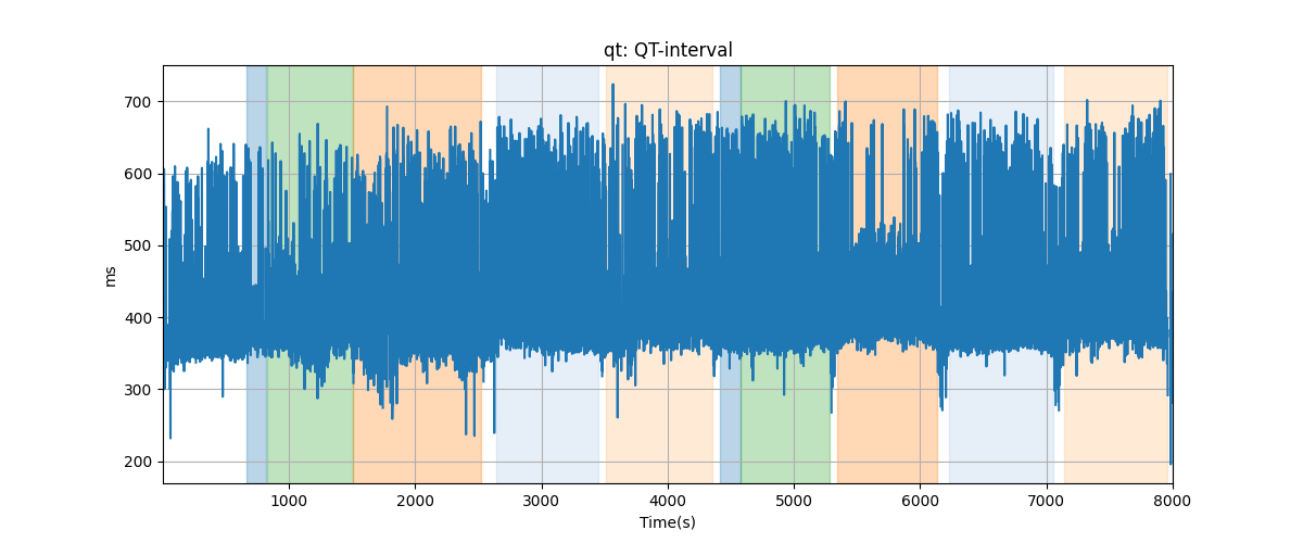 qt: QT-interval