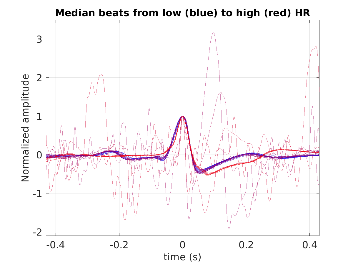 S029_ecg_med_beats_hr_binned