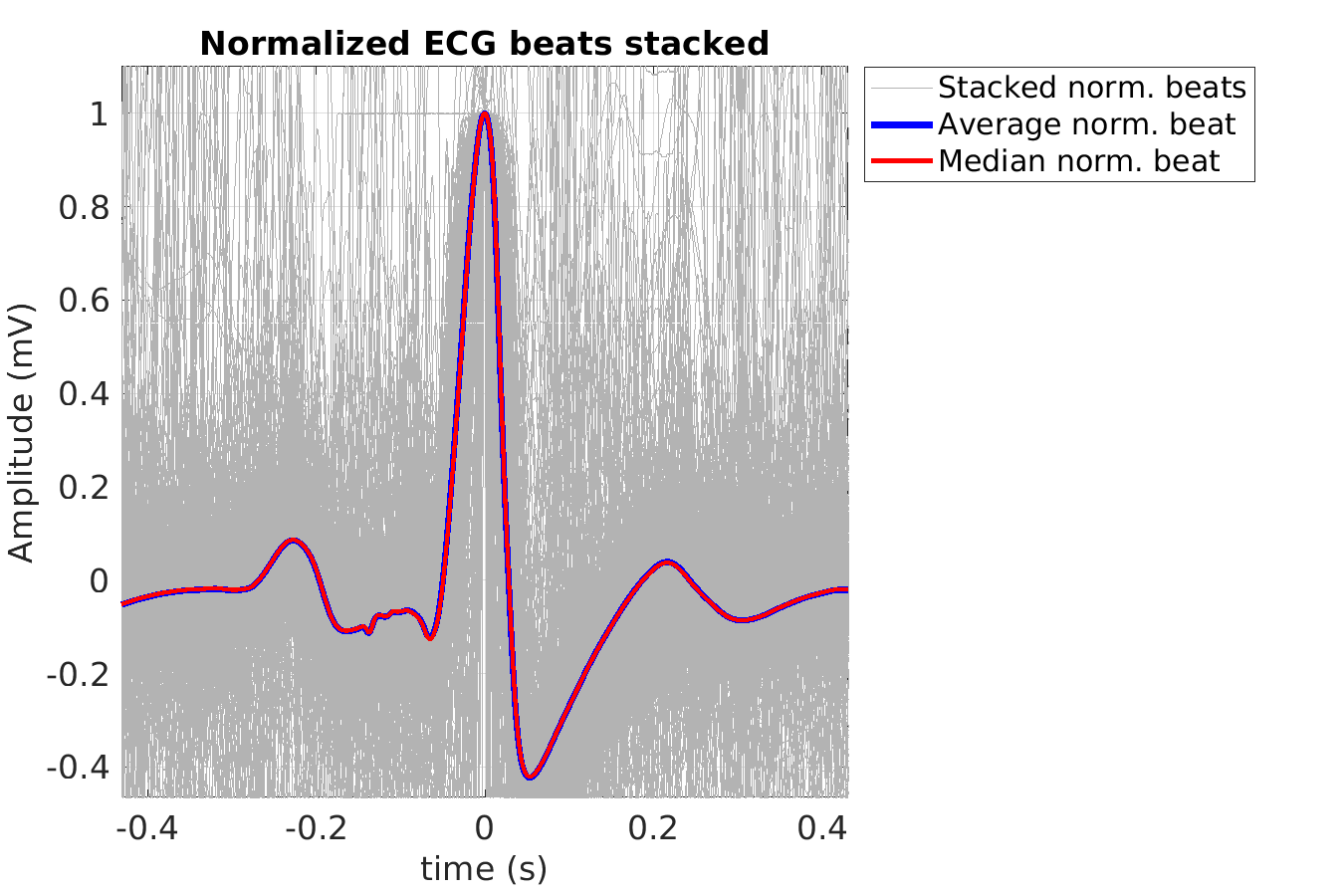 S029_ecg_norm_beats_stacked