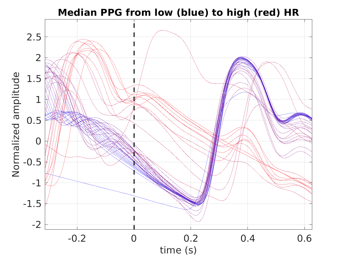 S029_ppg_med_ppg_hr_binned_norm