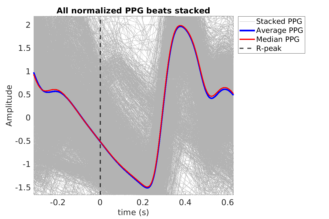 S029_ppg_ppg_stacked_norm