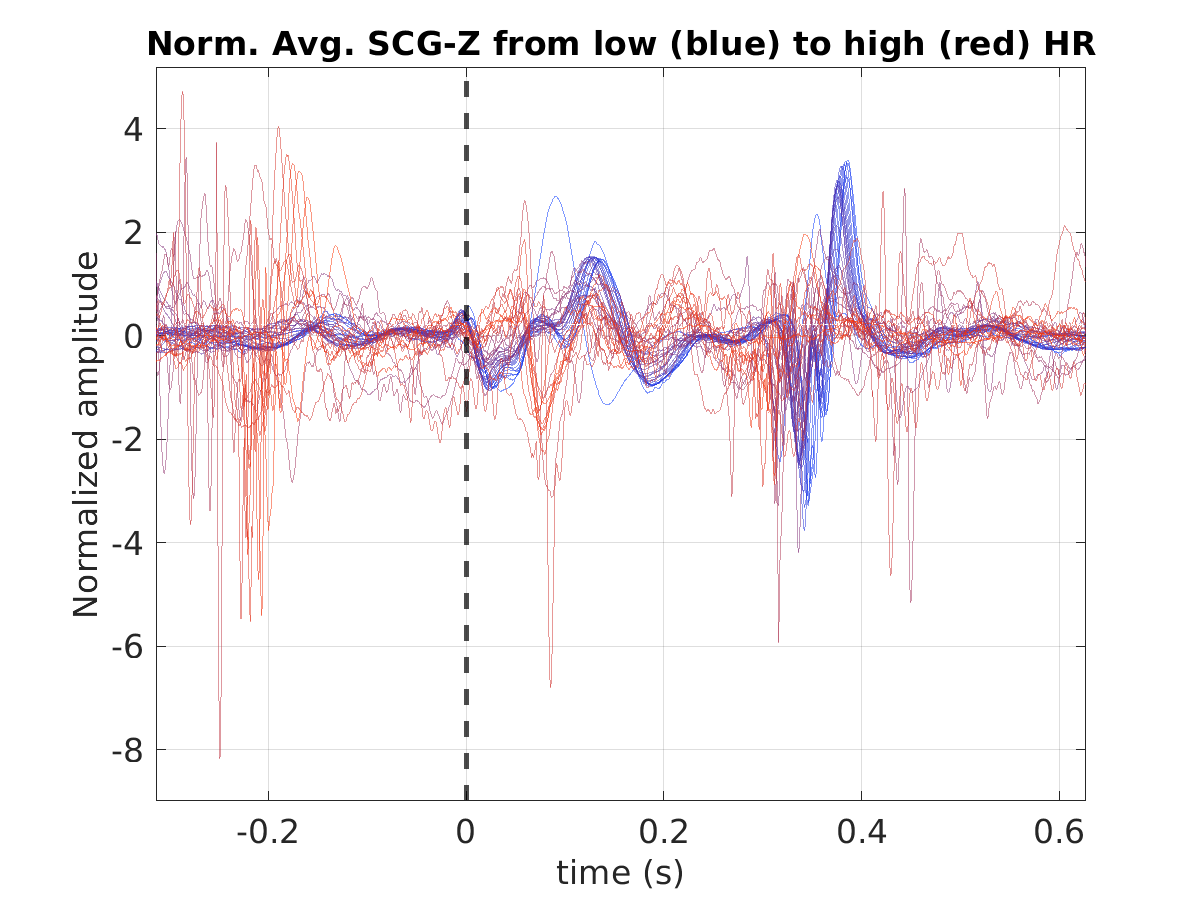 S029_scg_avg_scgz_hr_binned_norm