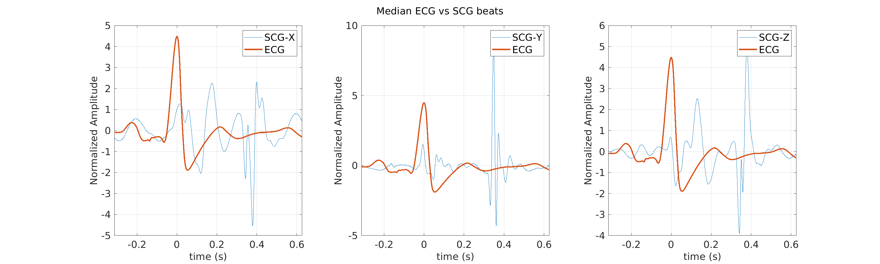 S029_scg_med_ecg_scg