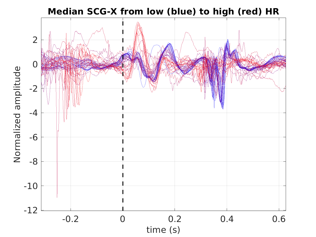 S029_scg_med_scgx_hr_binned_norm