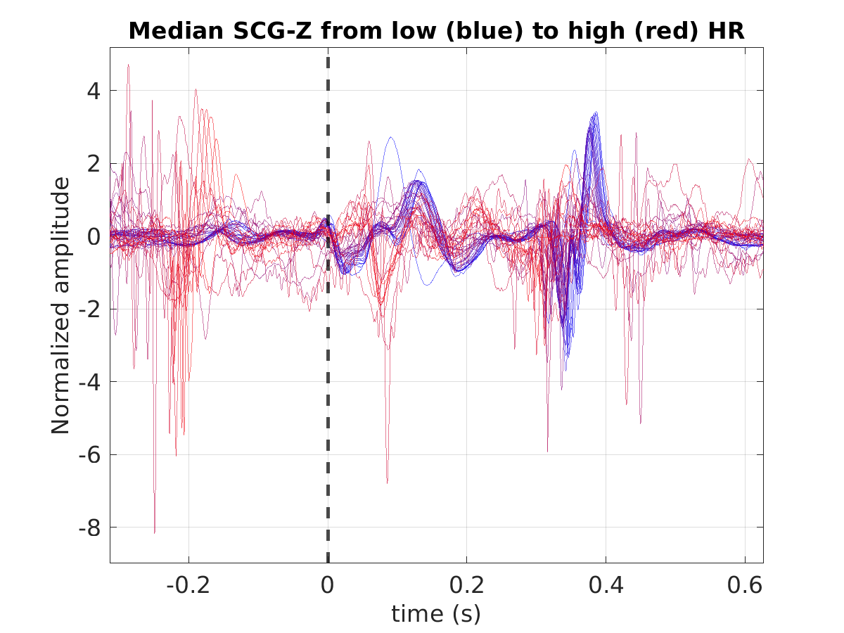 S029_scg_med_scgz_hr_binned_norm