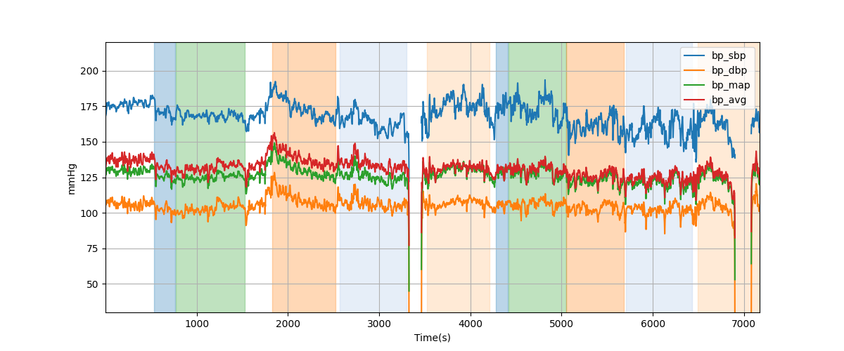 Subject S040 blood pressure data processing summary - Overlay