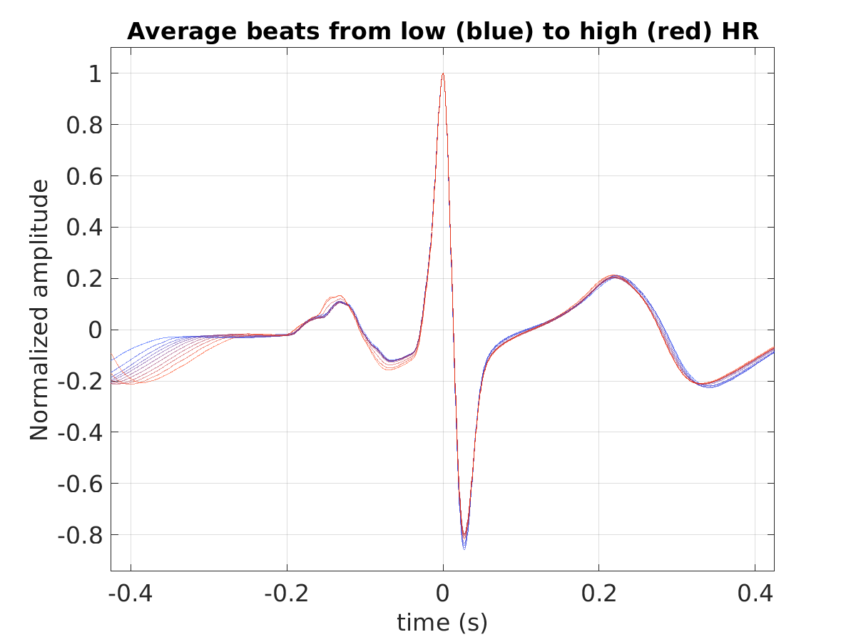 S040_ecg_avg_beats_hr_binned