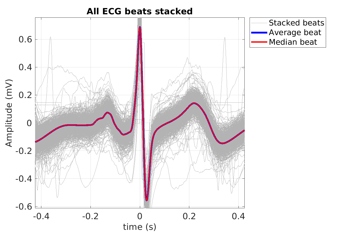 S040_ecg_beats_stacked