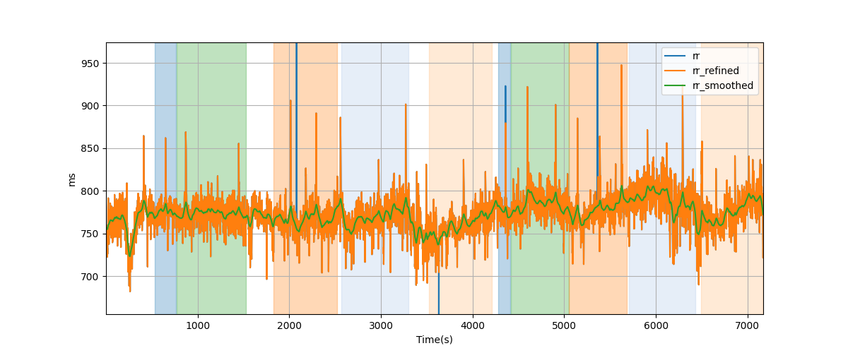 RR intervals - Overlay