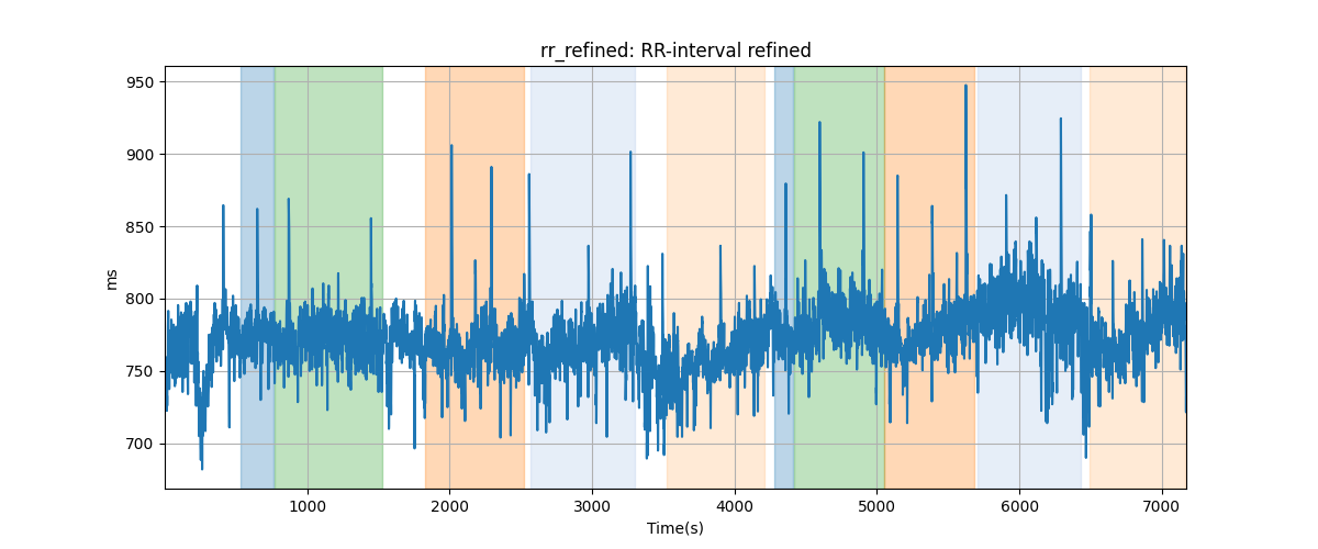 rr_refined: RR-interval refined