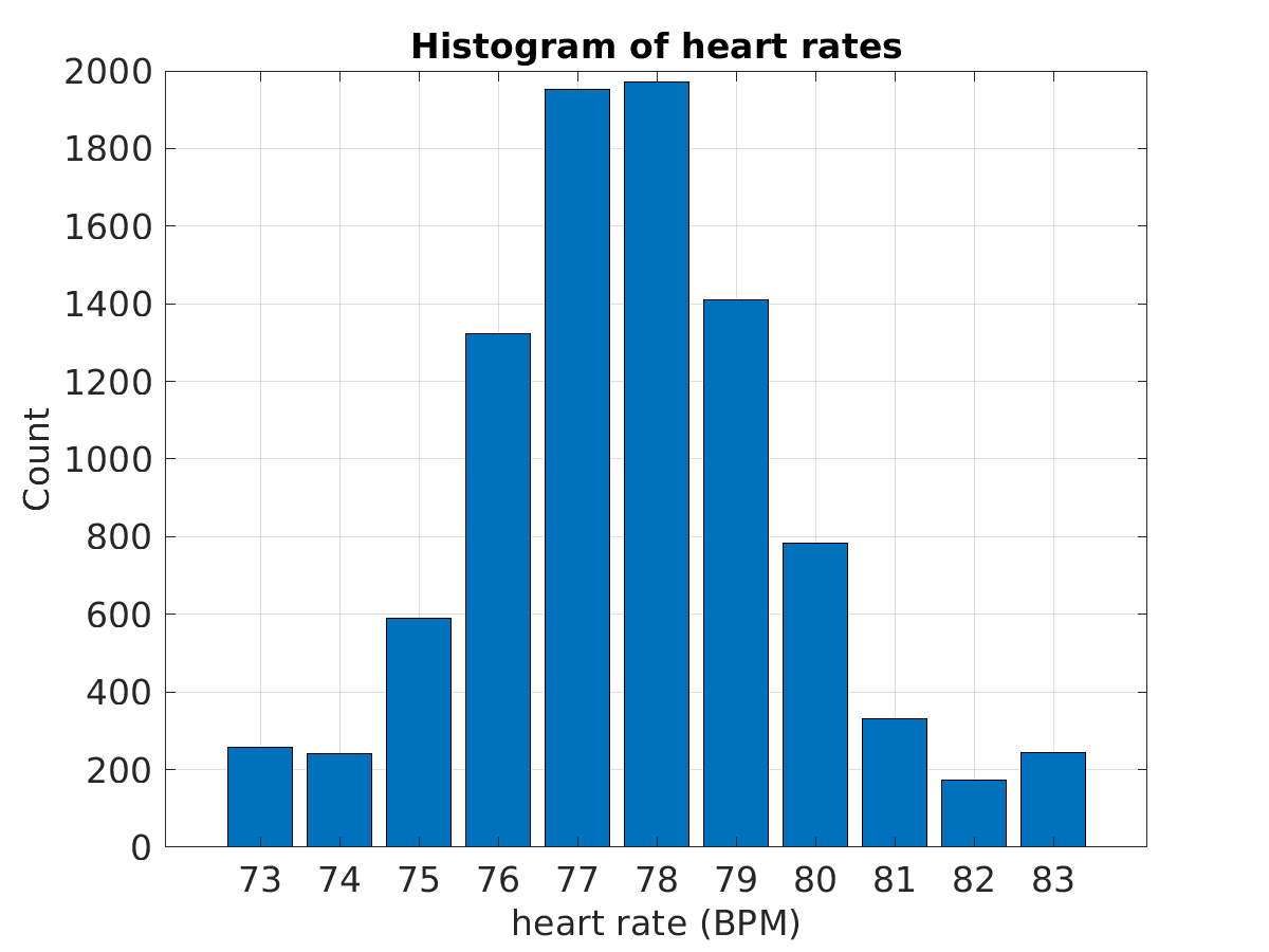 S040_ecg_hr_hist