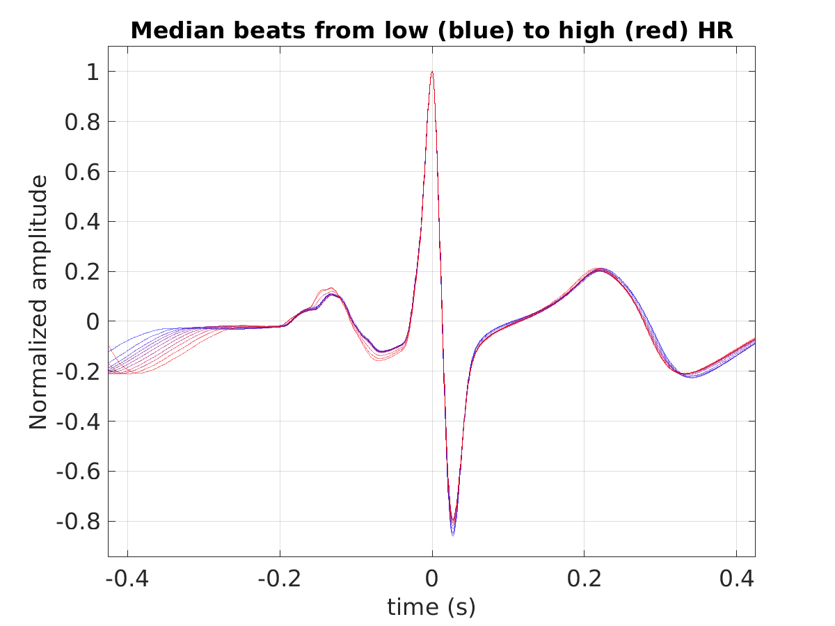 S040_ecg_med_beats_hr_binned