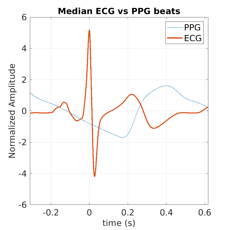 S040_ppg_med_ecg_ppg