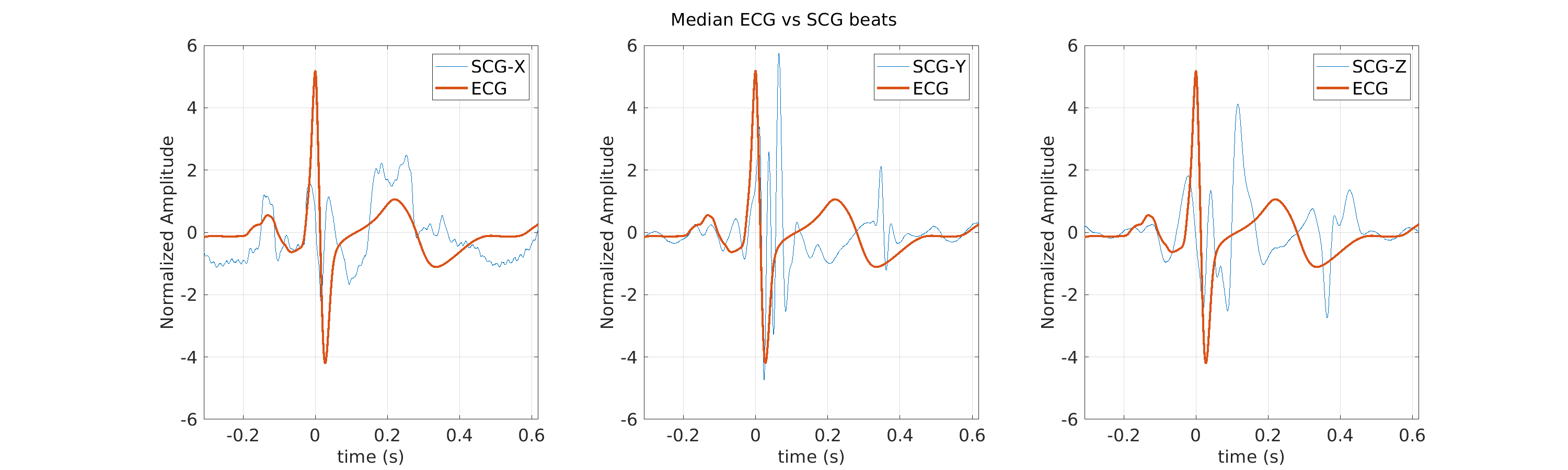 S040_scg_med_ecg_scg