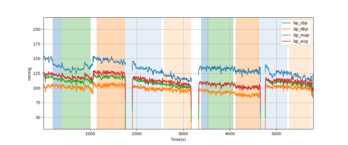 Subject S043 blood pressure data processing summary - Overlay