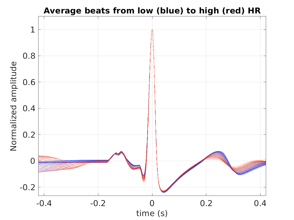 S043_ecg_avg_beats_hr_binned