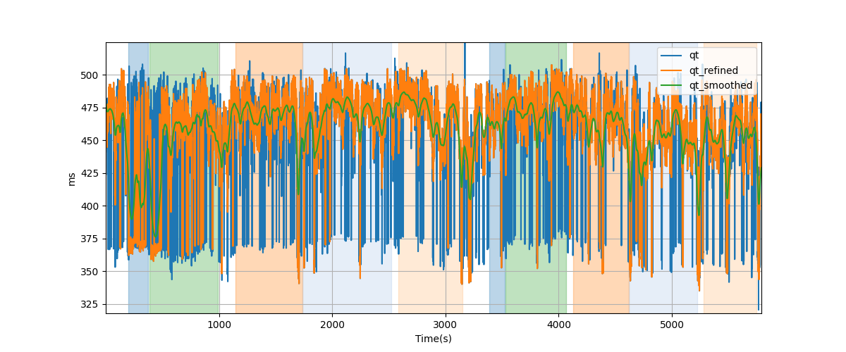 QT intervals - Overlay