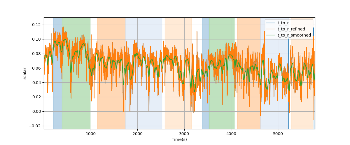 T/R wave ratio - Overlay