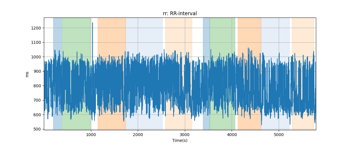 rr: RR-interval