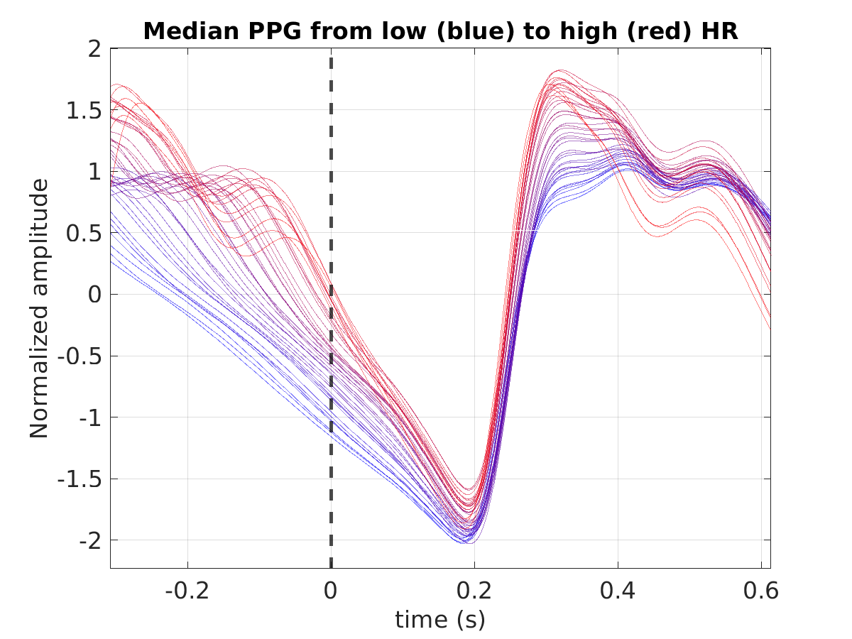 S043_ppg_med_ppg_hr_binned_norm