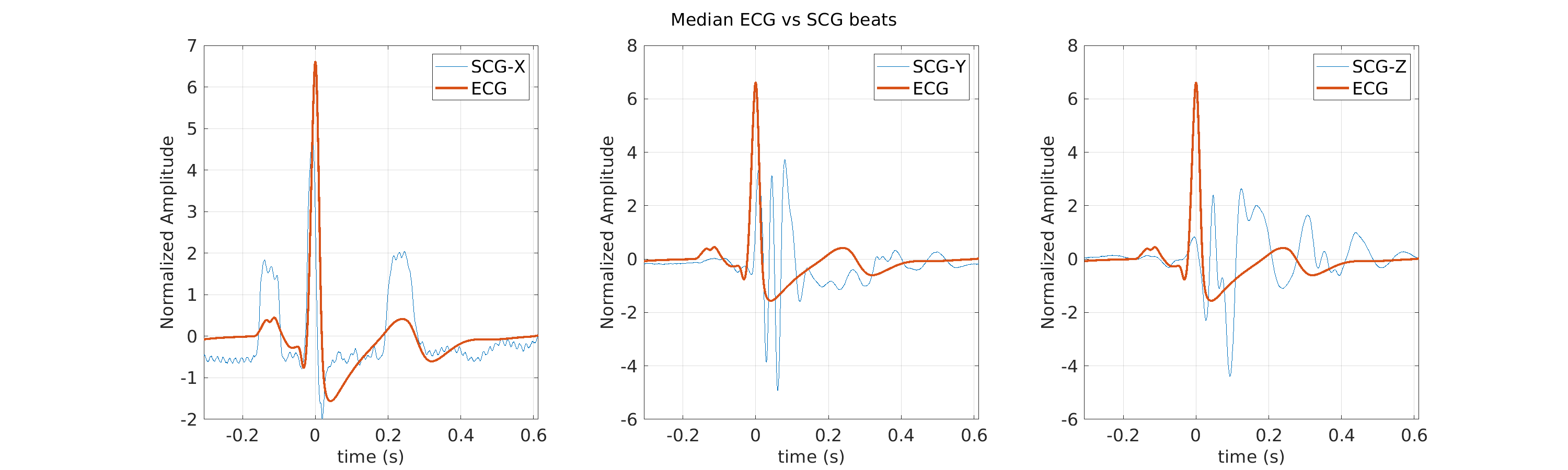 S043_scg_med_ecg_scg