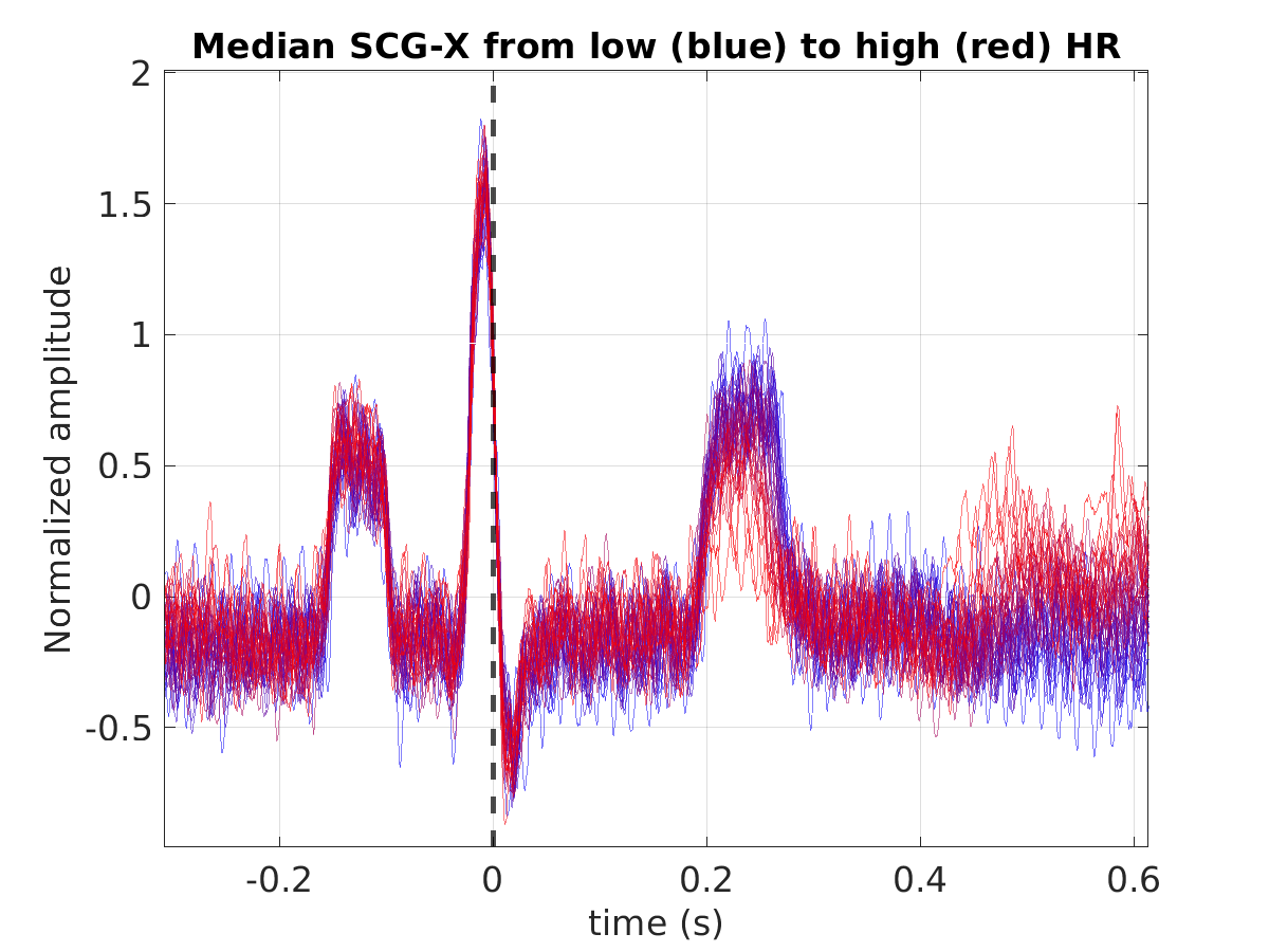 S043_scg_med_scgx_hr_binned_norm